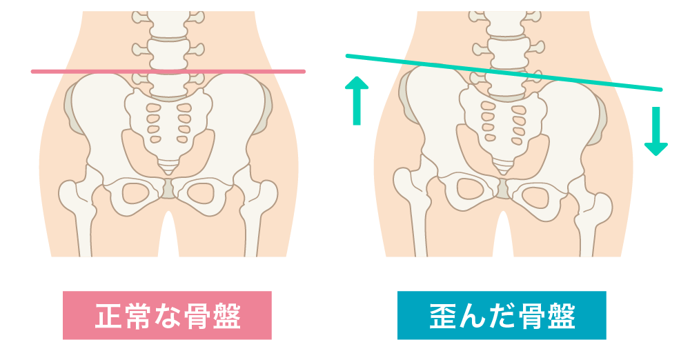 骨盤