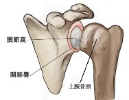 SLAP損傷　原因