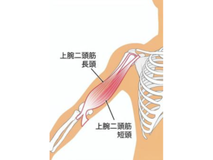 上腕二頭筋長頭腱炎