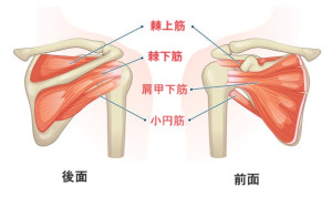 肩関節石灰化炎